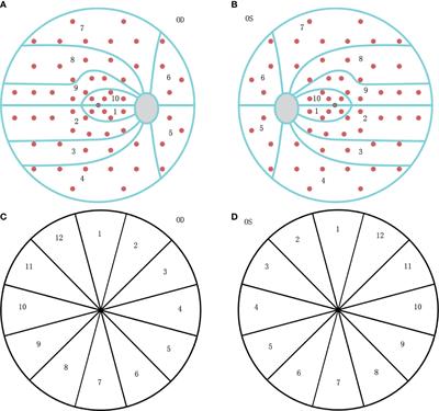 The different structure-function correlation as measured by OCT and octopus perimetry cluster analysis in intracranial tumor and glaucoma patients